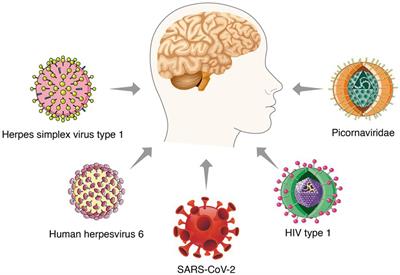 The viral hypothesis in Alzheimer’s disease: SARS-CoV-2 on the cusp